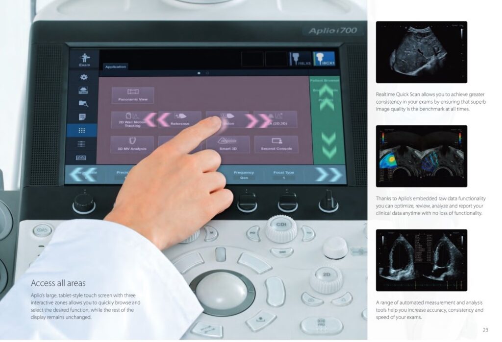 Canon I900 Series Premium Console Ultrasound Systems - Sono Solutions